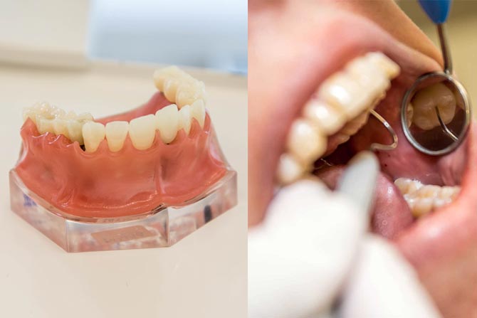 Best cosmetic dental treatments in Melbourne for 2025